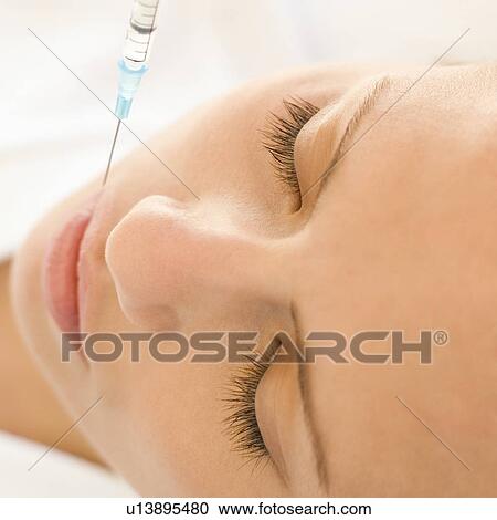 BOTOX® treatment View Large Photo Image Stock Image - BOTOX® treatment. Fotosearch