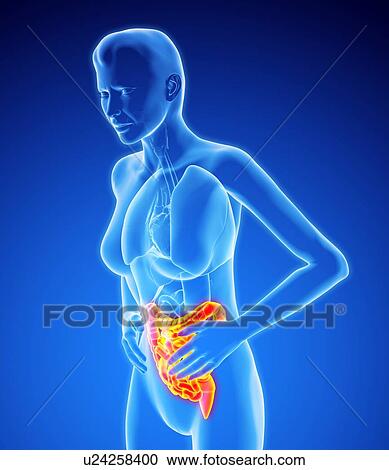 Stock Image - Bowel pain, artwork. Fotosearch