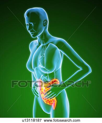 Stock Photo - Bowel pain, artwork. Fotosearch