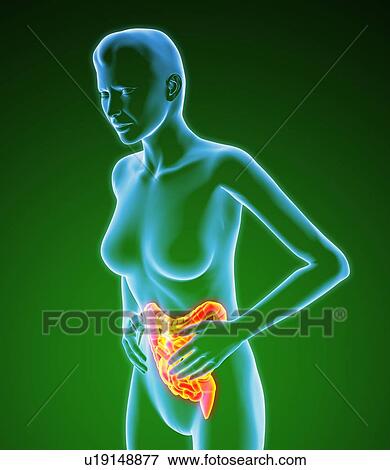 Stock Photo - Bowel pain, artwork. Fotosearch