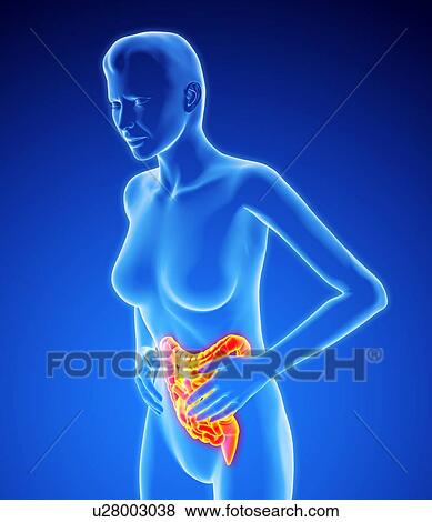 Stock Photo - Bowel pain, artwork. Fotosearch