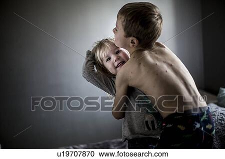 Boy with chickenpox View Large Photo Image Stock Image - Boy with chickenpox. Fotosearch