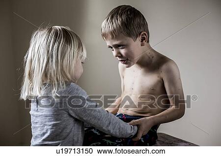 Stock Image - Boy with chickenpox. Fotosearch