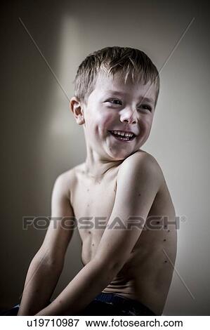 Stock Photo - Boy with chickenpox. Fotosearch