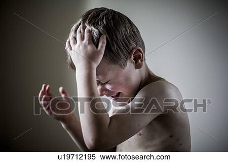 Stock Photography - Boy with chickenpox. Fotosearch