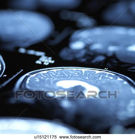 Brain scans View Large Photo Image Stock Photography - Brain scans. Fotosearch