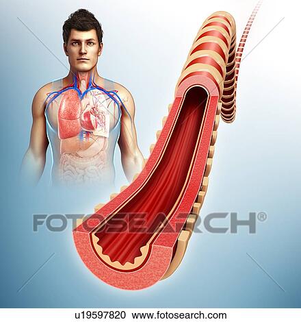 Stock Image - Bronchus of the human lung, illustration. Fotosearch