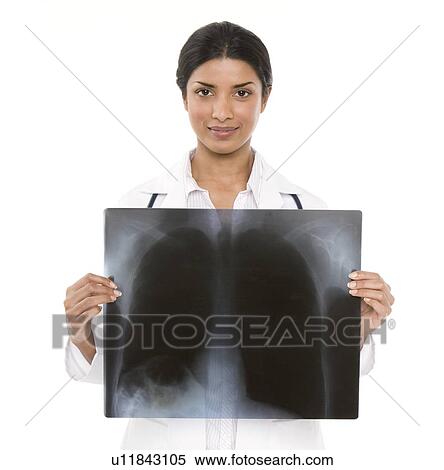 Chest X-ray View Large Photo Image Stock Photography - Chest X-ray. Fotosearch