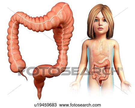 Stock Image - Child with mega colon, illustration. Fotosearch