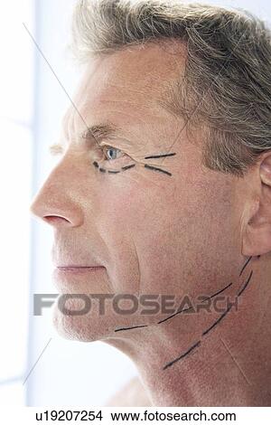 Picture - Cosmetic surgery. Fotosearch