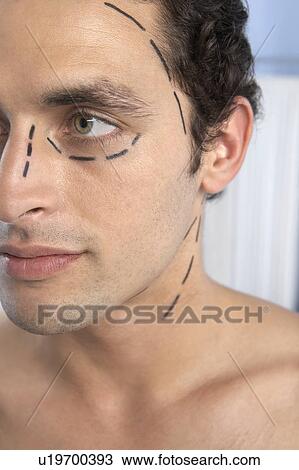 Stock Image - Cosmetic surgery. Fotosearch