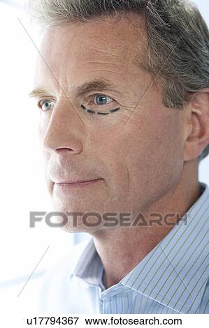 Stock Photo - Cosmetic surgery. Fotosearch