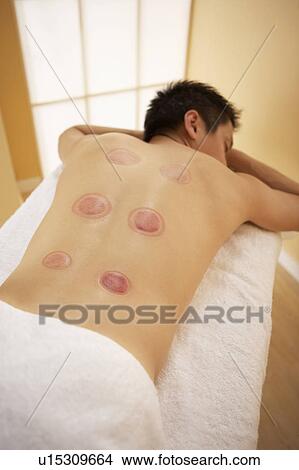 Cupping View Large Photo Image Picture - Cupping. Fotosearch