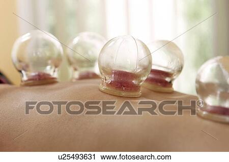 Cupping View Large Photo Image Stock Image - Cupping. Fotosearch