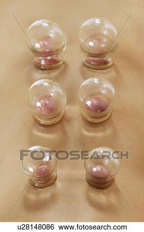Stock Photograph - Cupping. Fotosearch