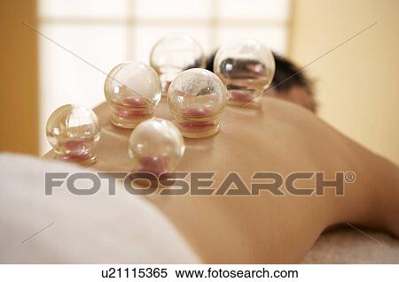 Stock Photography - Cupping. Fotosearch