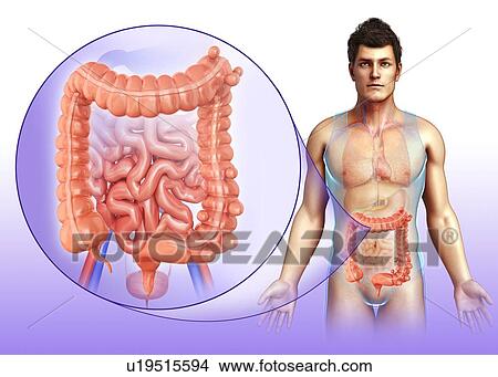 Picture - Diverticulosis, illustration. Fotosearch