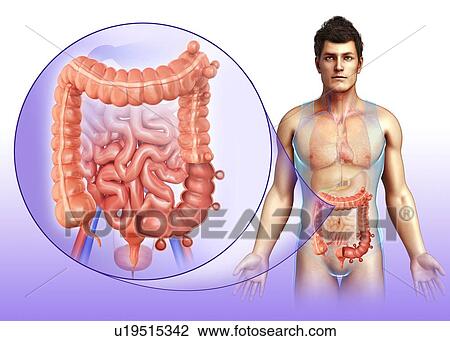 Stock Image - Diverticulosis, illustration. Fotosearch