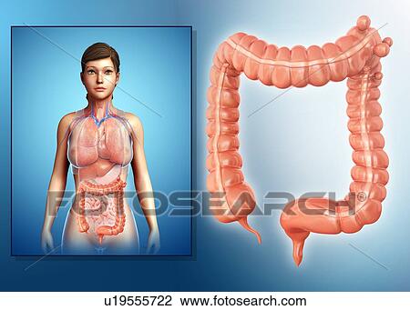 Stock Image - Diverticulosis, illustration. Fotosearch