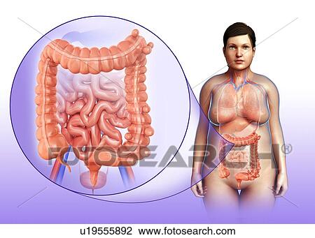 Stock Image - Diverticulosis, illustration. Fotosearch