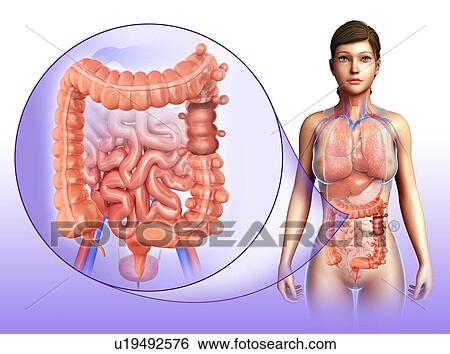 Diverticulosis, illustration View Large Photo Image Stock Photograph - Diverticulosis, illustration. Fotosearch
