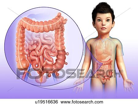 Stock Photograph - Diverticulosis, illustration. Fotosearch