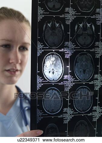 Doctor studying an MRI scan View Large Photo Image Stock Image - Doctor studying an MRI scan. Fotosearch