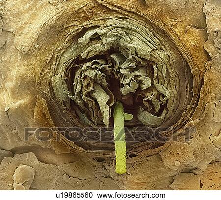 Stock Image - Eyelash follicle, SEM. Fotosearch