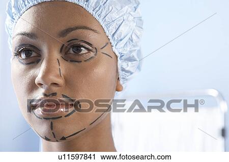 Facelift surgery markings View Large Photo Image Stock Image - Facelift surgery markings. Fotosearch