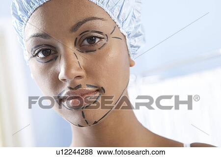 Facelift surgery markings View Large Photo Image Stock Photo - Facelift surgery markings. Fotosearch
