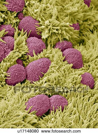 Stock Image - Fallopian tube cells, SEM. Fotosearch