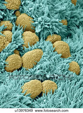 Fallopian tube cells, SEM View Large Photo Image Stock Photo - Fallopian tube cells, SEM. Fotosearch