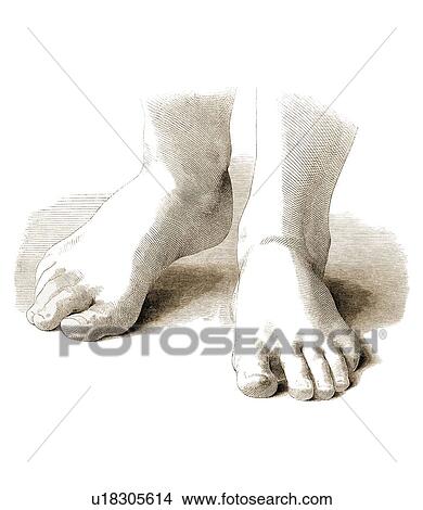 Picture - Feet, artwork. Fotosearch