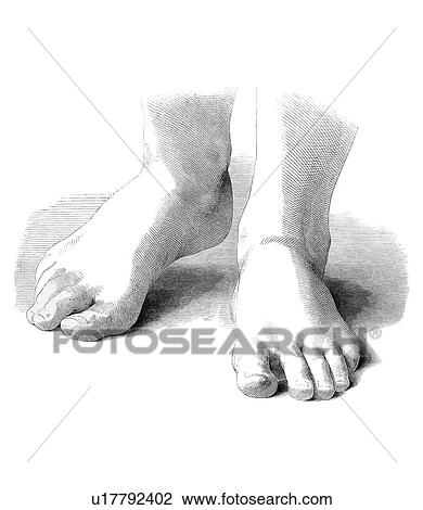 Stock Image - Feet, artwork. Fotosearch