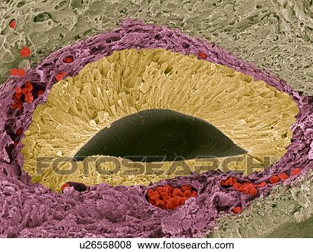 Stock Photo - Foetal sense organ, SEM. Fotosearch