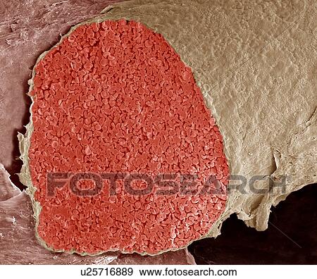 Stock Photo - Foetal vein, SEM. Fotosearch