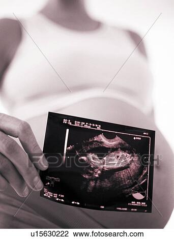 Stock Image - Foetus ultrasound. Fotosearch