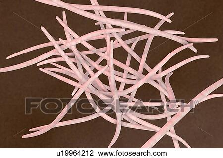 Fusobacterium, illustration View Large Photo Image Stock Image - Fusobacterium, illustration. Fotosearch