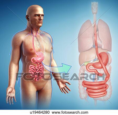 Gastric bypass, illustration View Large Photo Image Stock Image - Gastric bypass, illustration. Fotosearch
