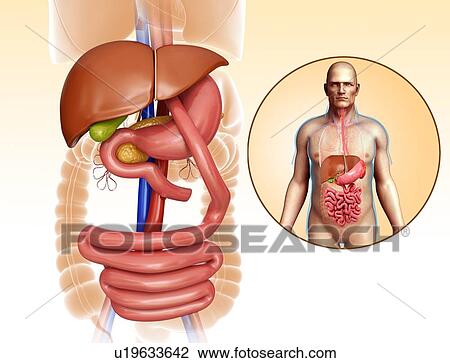 Stock Image - Gastric bypass, illustration. Fotosearch