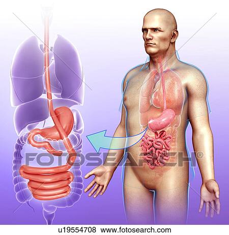 Stock Photo - Gastric bypass, illustration. Fotosearch