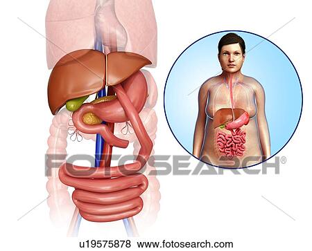 Stock Photo - Gastric bypass, illustration. Fotosearch