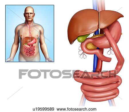 Stock Photo - Gastric bypass, illustration. Fotosearch