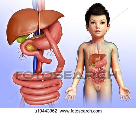 Stock Image - Gastric bypass in a child, illustration. Fotosearch