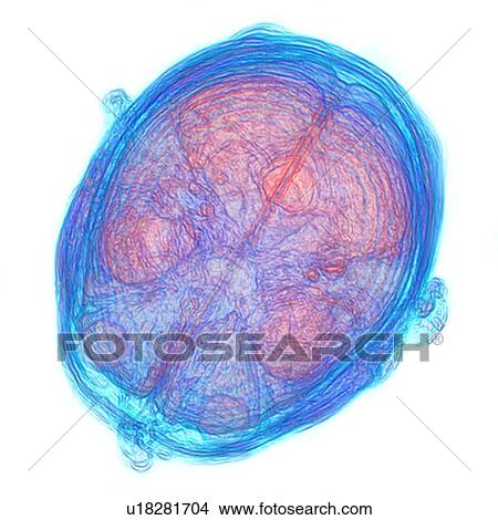 Picture - Human brain, 3D-MRI scan. Fotosearch