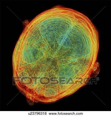 Stock Photo - Human brain, 3D-MRI scan. Fotosearch