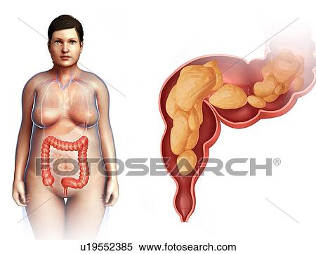 Human large intestine, illustration View Large Photo Image Stock Photography - Human large intestine, illustration. Fotosearch