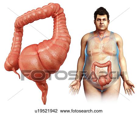 Stock Image - Human mega colon, illustration. Fotosearch