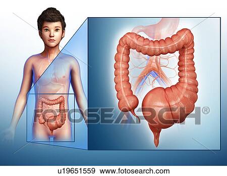 Human megacolon, illustration View Large Photo Image Stock Photo - Human megacolon, illustration. Fotosearch