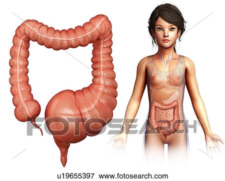 Human megacolon, illustration View Large Photo Image Stock Photo - Human megacolon, illustration. Fotosearch
